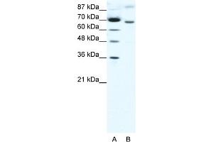 WB Suggested Anti-RACGAP1 Antibody Titration:  1. (RACGAP1 antibody  (N-Term))