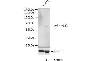 Western blot analysis of extracts of A-431 cells, using Phospho-Fyn-S21 antibody (ABIN6135226, ABIN6136086, ABIN6136087 and ABIN6225545) at 1:1000 dilution. (FYN antibody  (pSer21))
