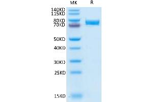 Human B7-H4 on Tris-Bis PAGE under reduced condition. (VTCN1 Protein (AA 29-258) (Fc Tag))
