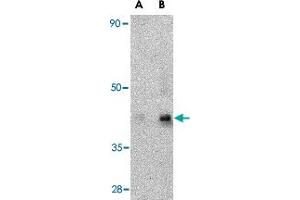 Western blot analysis of GPR44 in human heart tissue lysate with GPR44 polyclonal antibody  at (A) 1 and (B) 2 ug/mL . (Prostaglandin D2 Receptor 2 (PTGDR2) (Internal Region) antibody)