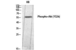 Western Blotting (WB) image for anti-V-Akt Murine Thymoma Viral Oncogene Homolog 1 (AKT1) (pTyr326) antibody (ABIN3173033) (AKT1 antibody  (pTyr326))
