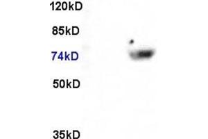 L1 Rat brain lysate L2 human colon carcinoma 30ug, probed (ABIN731168) at 1:200 in 4 °C. (FOXO3 antibody  (AA 581-673))