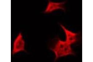 ABIN6266842 staining HuvEc by IF/ICC. (FARP2 antibody  (Internal Region))