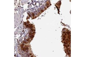 Immunohistochemical staining (Formalin-fixed paraffin-embedded sections) of human bronchus with GPR133 polyclonal antibody  shows strong cytoplasmic positivity in respiratory epithelial cells with distinct extracellular material. (G Protein-Coupled Receptor 133 antibody)