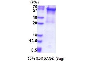 SDS-PAGE (SDS) image for Keratin 5 (KRT5) (AA 1-590) protein (His tag) (ABIN5853651) (Cytokeratin 5 Protein (AA 1-590) (His tag))