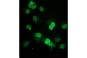 Immunofluorescence (IF) image for anti-Tumor Protein P53 (TP53) antibody (ABIN1499972) (p53 antibody)