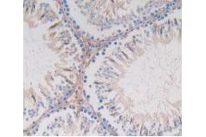 Figure. (GSTA4 antibody  (AA 2-222))