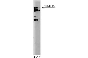 Western Blotting (WB) image for anti-Phosphoinositide-3-Kinase, Catalytic, delta Polypeptide (PIK3CD) (AA 73-90) antibody (ABIN968316) (PIK3CD antibody  (AA 73-90))