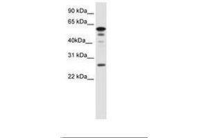 Image no. 1 for anti-Forkhead Box D1 (FOXD1) (AA 24-73) antibody (ABIN6736081) (FOXD1 antibody  (AA 24-73))