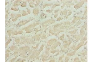 Immunohistochemistry of paraffin-embedded human heart tissue using ABIN7155010 at dilution of 1:100 (HS3ST1 antibody  (AA 21-307))