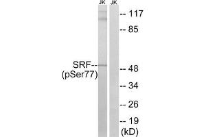 Western blot analysis of extracts from Jurkat cells, treated with PMA (125 ng/mL, 30 mins), using SRF (Phospho-Ser77) antibody. (SRF antibody  (pSer77))