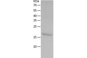 Western Blotting (WB) image for Peroxiredoxin 5 (PRDX5) (AA 53-214) protein (His tag) (ABIN7285902) (Peroxiredoxin 5 Protein (PRDX5) (AA 53-214) (His tag))