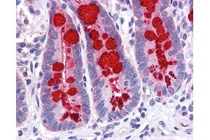 Anti-SLC9A3R1 / NHERF1 antibody IHC of human small intestine. (SLC9A3R1 antibody  (AA 252-359))