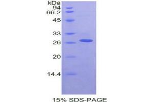 SDS-PAGE analysis of Rat RIPK3 Protein.
