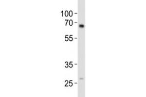 Western blot analysis of lysate from mouse kidney tissue using ALK3 antibody diluted at 1:1000.