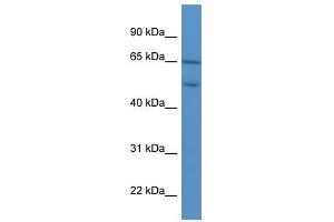 COL8A2 antibody used at 0.