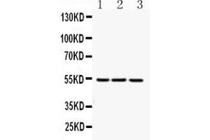 Western blot analysis of FGG expression in rat liver extract ( Lane 1), mouse liver extract ( Lane 2) and HEPG2 whole cell lysates ( Lane 3). (FGG antibody  (N-Term))