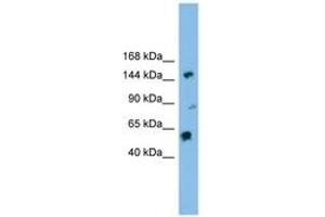 Image no. 1 for anti-DEAH (Asp-Glu-Ala-His) Box Polypeptide 8 (DHX8) (AA 71-120) antibody (ABIN6744511) (DHX8 antibody  (AA 71-120))