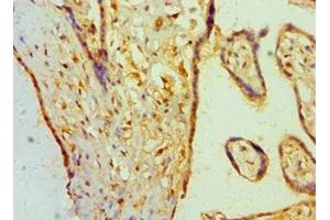 Immunohistochemistry of paraffin-embedded human placenta tissue using ABIN7145641 at dilution of 1:100
