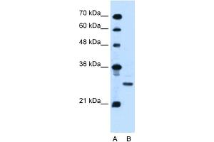 WB Suggested Anti-PDPN Antibody Titration:  0. (Podoplanin antibody  (N-Term))