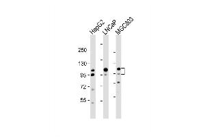 Western Blot at 1:2000 dilution Lane 1: HepG2 whole cell lysate Lane 2: LNCaP whole cell lysate Lane 3: MGC803 whole cell lysate Lysates/proteins at 20 ug per lane. (Anoctamin 7 antibody  (N-Term))