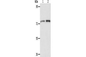 Gel: 8 % SDS-PAGE, Lysate: 40 μg, Lane 1-2: Mouse liver tissue, Mouse kidney tissue, Primary antibody: ABIN7128172(ACOX2 Antibody) at dilution 1/350, Secondary antibody: Goat anti rabbit IgG at 1/8000 dilution, Exposure time: 2 minutes (Acox2 antibody)