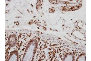 Image no. 1 for anti-Transcription Elongation Regulator 1 (TCERG1) (AA 419-1077) antibody (ABIN1501339) (TCERG1 antibody  (AA 419-1077))