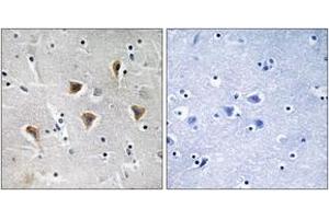 Immunohistochemistry analysis of paraffin-embedded human brain tissue, using MTERF Antibody. (MTERF antibody  (AA 267-316))