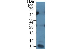 Detection of IL7 in Human Leukocyte lysate using Monoclonal Antibody to Interleukin 7 (IL7) (IL-7 antibody  (AA 26-177))