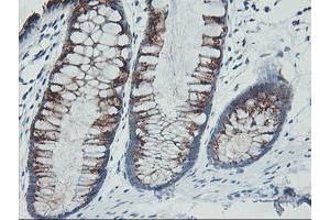 Immunohistochemical staining of paraffin-embedded Human colon tissue using anti-GOLM1 mouse monoclonal antibody.