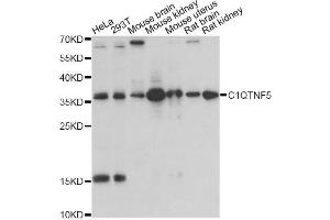 Western blot analysis of extracts of various cell lines, using C1QTNF5 antibody (ABIN1871381) at 1:1000 dilution.