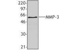Western Blotting (WB) image for anti-Matrix Metallopeptidase 3 (Stromelysin 1, Progelatinase) (MMP3) antibody (ABIN2666353) (MMP3 antibody)