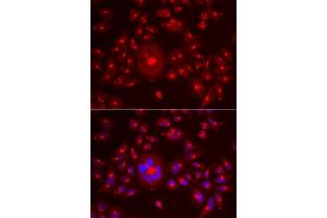 Immunofluorescence analysis of A549 cells using GORASP1 antibody. (GORASP1 antibody  (AA 221-440))