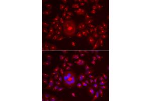 Immunofluorescence analysis of A549 cells using GORASP1 antibody. (GORASP1 antibody  (AA 221-440))