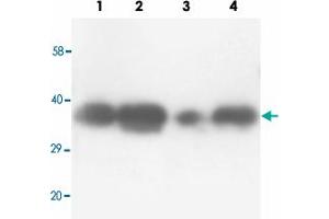 Western blot analysis of tissue lysates with TNFAIP1 polyclonal antibody .