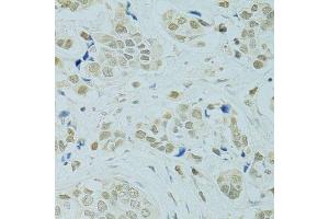 Immunohistochemistry (Paraffin-embedded Sections) (IHC (p)) image for anti-Regulator of Chromosome Condensation 1 (RCC1) (AA 1-240) antibody (ABIN6146817)