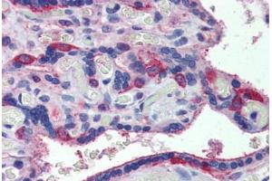 Human Placenta: Formalin-Fixed, Paraffin-Embedded (FFPE) (MARCH8 antibody  (C-Term))