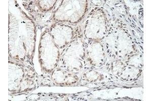 IHC analysis of formalin-fixed paraffin embedded fetal stomach, with cytoplasmic and membrane staining, using CMTM4 antibody (1/100 dilution).