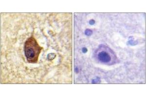 Immunohistochemistry analysis of paraffin-embedded human brain tissue, using Synapsin1 (Ab-605) Antibody. (SYN1 antibody  (AA 576-625))