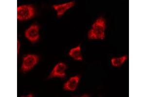 ABIN6278607 staining Hela by IF/ICC. (OR2T5/2T29 antibody)