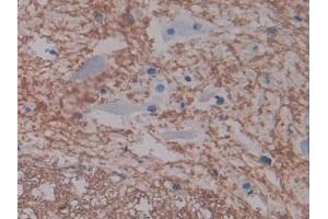 Immunohistochemistry (IHC) image for anti-Intercellular Adhesion Molecule 1 (ICAM1) (AA 102-306) antibody (ABIN7431977)