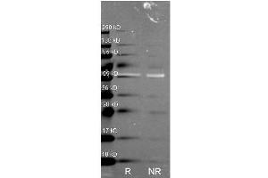 Western Blot of Rabbit anti-Catalase antibody. (Catalase antibody)
