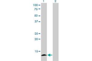 Western Blot analysis of APOC4 expression in transfected 293T cell line by APOC4 monoclonal antibody (M01), clone 3D10. (APOC4 antibody  (AA 27-127))