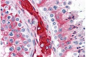 Human Testis: Formalin-Fixed, Paraffin-Embedded (FFPE) (WDR35 antibody  (N-Term))