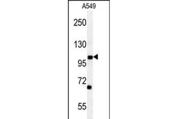 DPY19L2 anticorps  (C-Term)