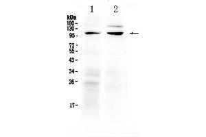 Western Blotting (WB) image for anti-Transient Receptor Potential Cation Channel, Subfamily C, Member 6 (TRPC6) (AA 771-875) antibody (ABIN5518963)