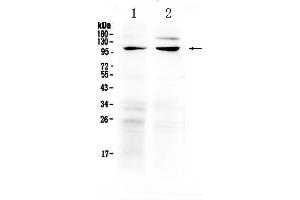 Western blot analysis of TRPC6 using anti-TRPC6 antibody . (TRPC6 antibody  (AA 771-875))