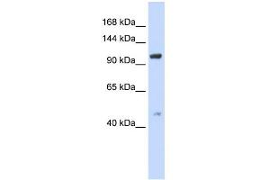 WB Suggested Anti-TRPC4 Antibody Titration:  0. (TRPC4 antibody  (Middle Region))