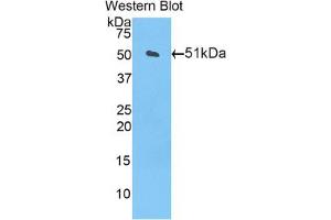 Western blot analysis of the recombinant protein. (CPT1A antibody  (AA 568-773))