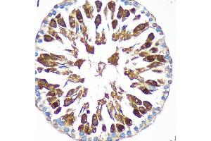 Immunohistochemistry of paraffin-embedded Rat testis using C Rabbit pAb (ABIN7266547) at dilution of 1:100 (40x lens). (CAND2 antibody  (AA 850-1000))